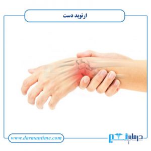 بهترین متخصص ارتوپد دست