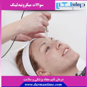 سوالات متداول میکرونیدلینگ