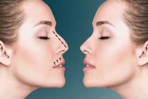 ارتباط کم خونی و جراحی بینی