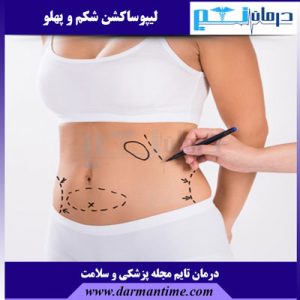 هزینه لیپوساکشن