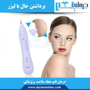 برداشتن خال با لیزر
