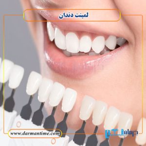 هزینه لمینت دندان