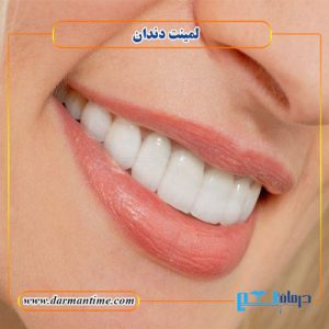 لمینت دندان