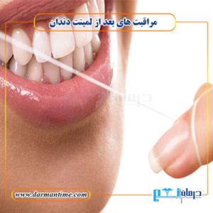 مراقبت های بعد از لمینت دندان