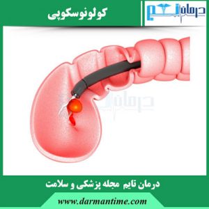 کولونوسکوپی
