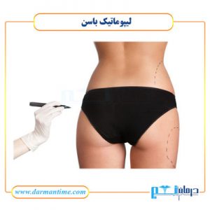 لیپوماتیک باسن
