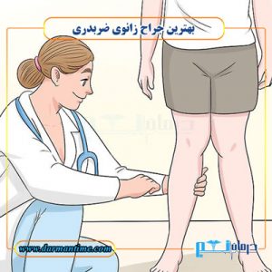 بهترین جراح زانوی ضربدری
