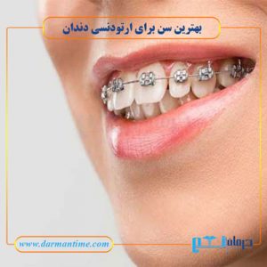 بهترین سن برای ارتودنسی دندان