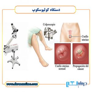 دستگاه کولپوسکوپ