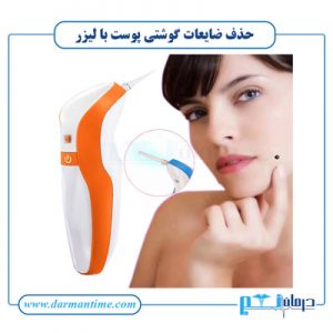 حذف ضایعات گوشتی پوست با لیزر