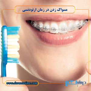 ارتودنسی دندان و مسواک زدن
