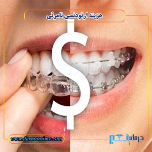 هزینه ارتودنسی نامرئی