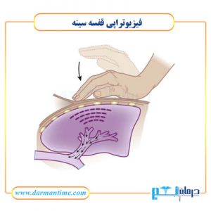 فیزیوتراپی قفسه سینه