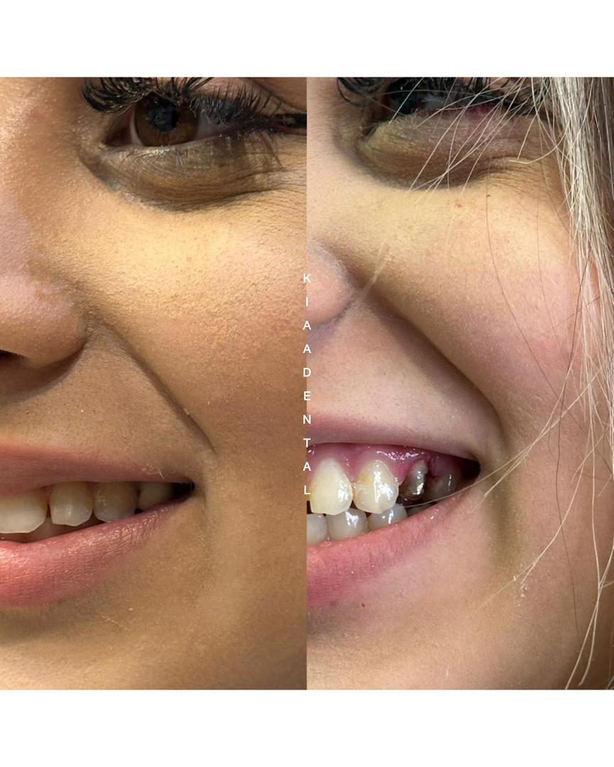 kia-dental-groups (2)