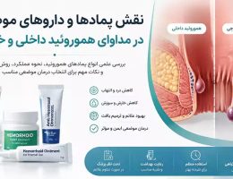 درمان هموروئید با پماد موضعی