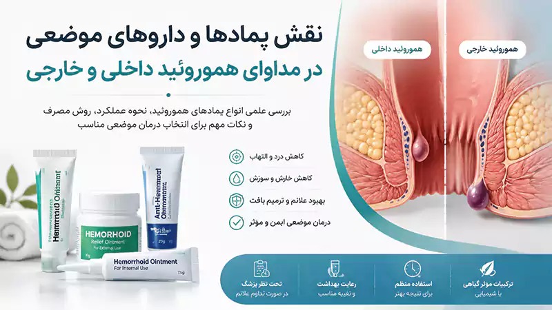 درمان هموروئید با پماد موضعی